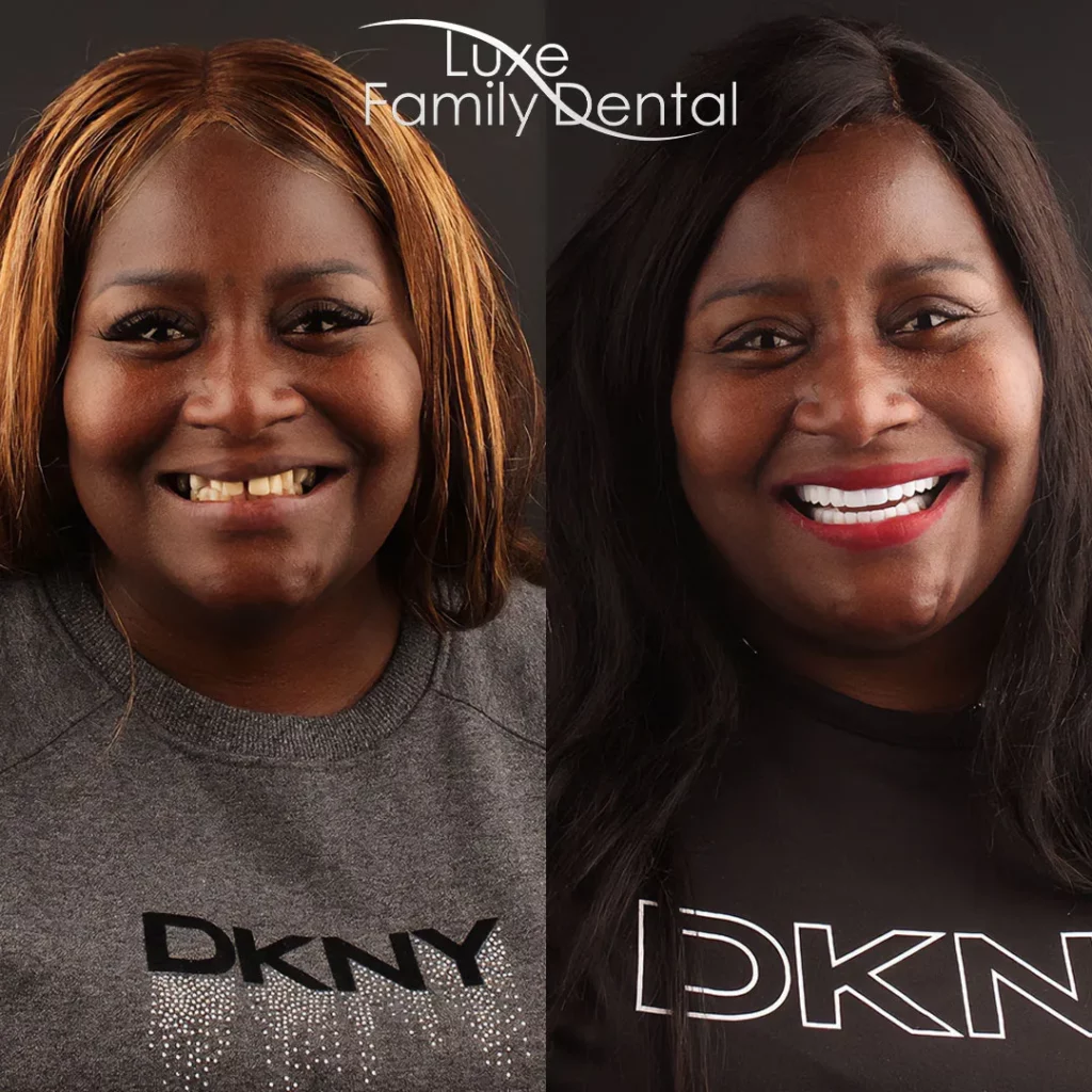 a woman smiling in her before and after photo