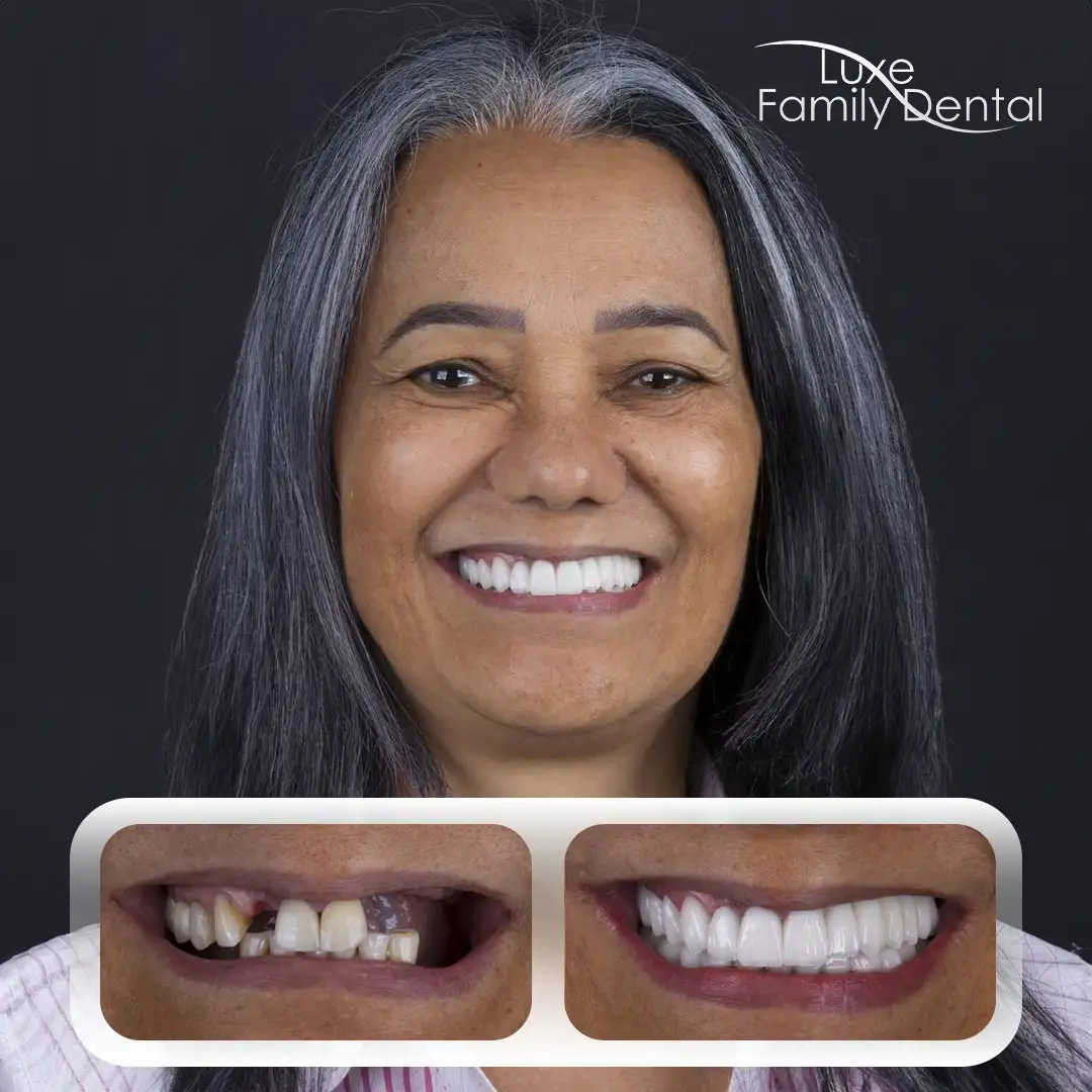 a woman smiling for a before and after picture